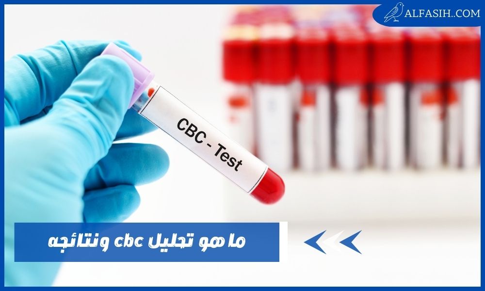ما هو تحليل cbc –  النتائج الطبيعية لفحص صورة الدم