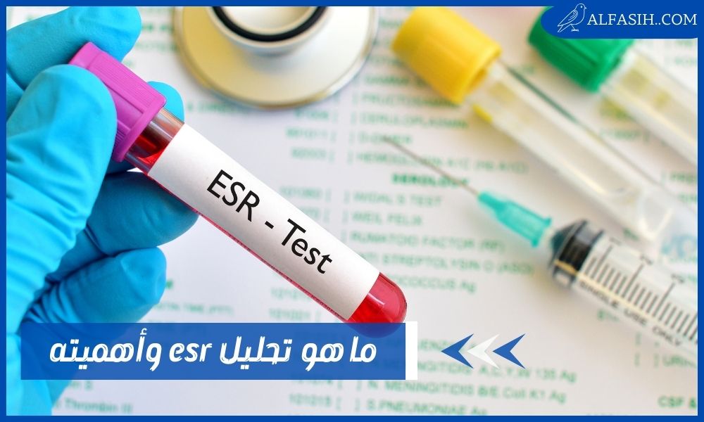ما هو تحليل esr وماذا تعني نتائجه؟ وما هي أمراض المناعة