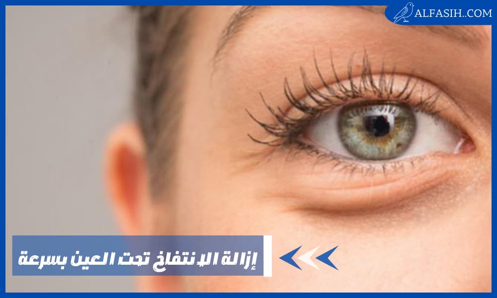كيفية إزالة الانتفاخ تحت العين بسرعة