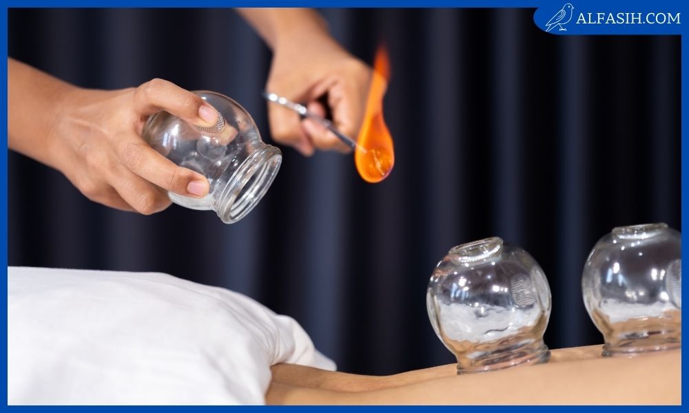 افضل ايام الحجامة 2