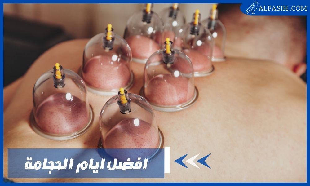 افضل ايام الحجامة وأهميتها وما قيل عنها في الإسلام
