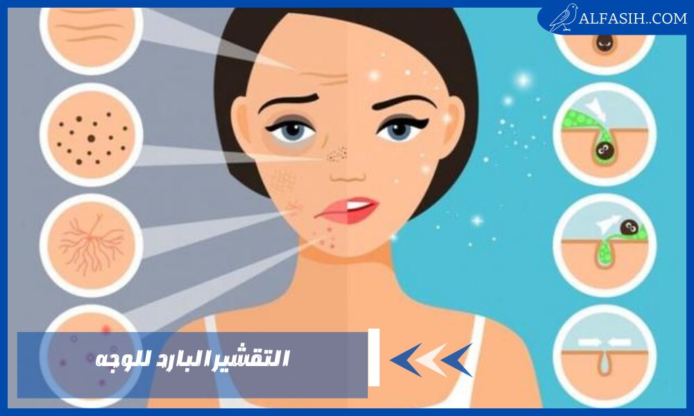 التقشير البارد للوجه
