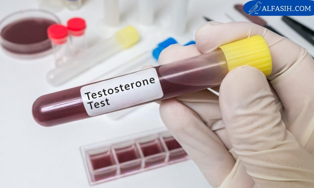 انخفاض مستويات هرمون التستوستيرون