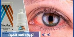 توبرادكس للعين للعدوى البكتيرية – هل تخفف من تورم العين؟