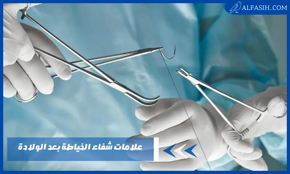 علامات شفاء الخياطة بعد الولادة