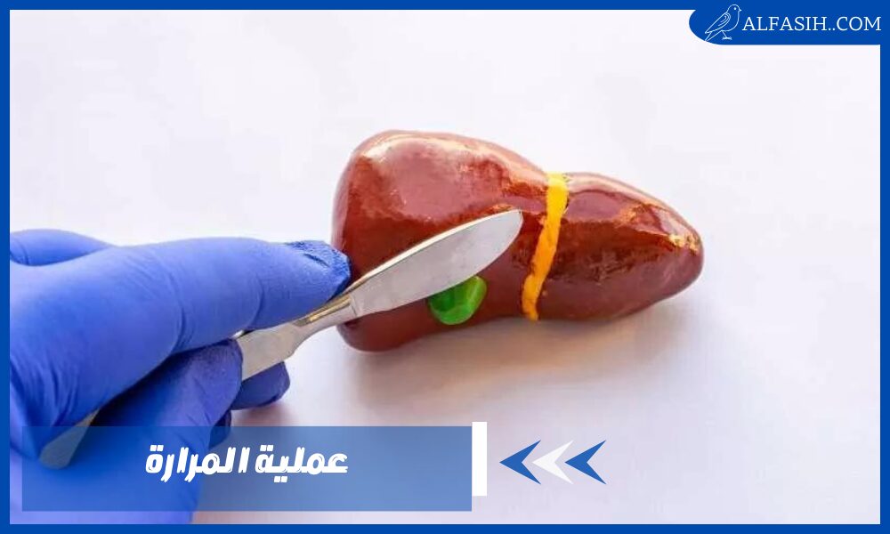 عملية المرارة 1
