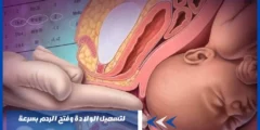 لتسهيل الولادة وفتح الرحم بسرعة – ولادة بدون ألم