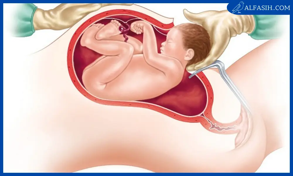 لتسهيل الولادة وفتح الرحم بسرعة2