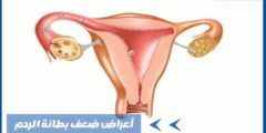أعراض ضعف بطانة الرحم وما نسبة تأثيرها على الحمل؟