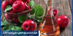 كيف استعمل خل التفاح لعلاج قشرة الشعر