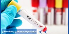ما هى اعراض مرض الايدز وطرق العلاج