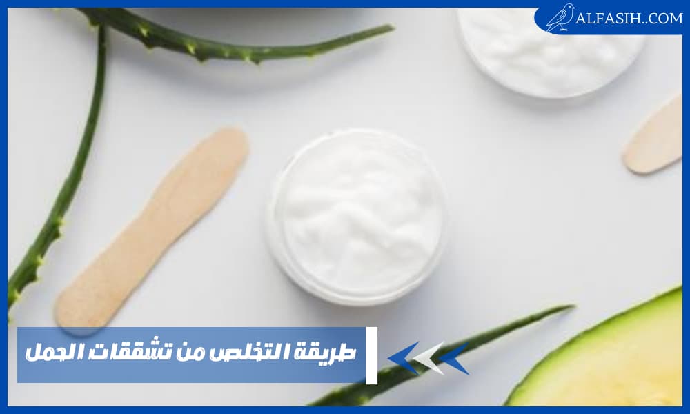 طريقة التخلص من تشققات الحمل