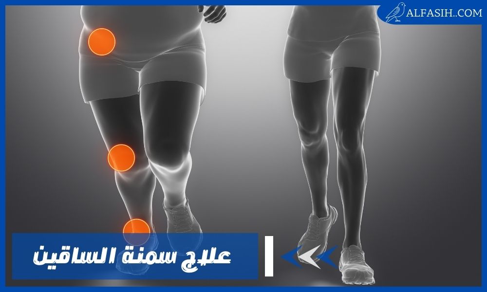 علاج سمنة الساقين والحصول على جسم متناسق جذاب