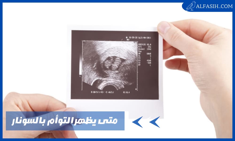 متى يظهر التوأم بالسونار