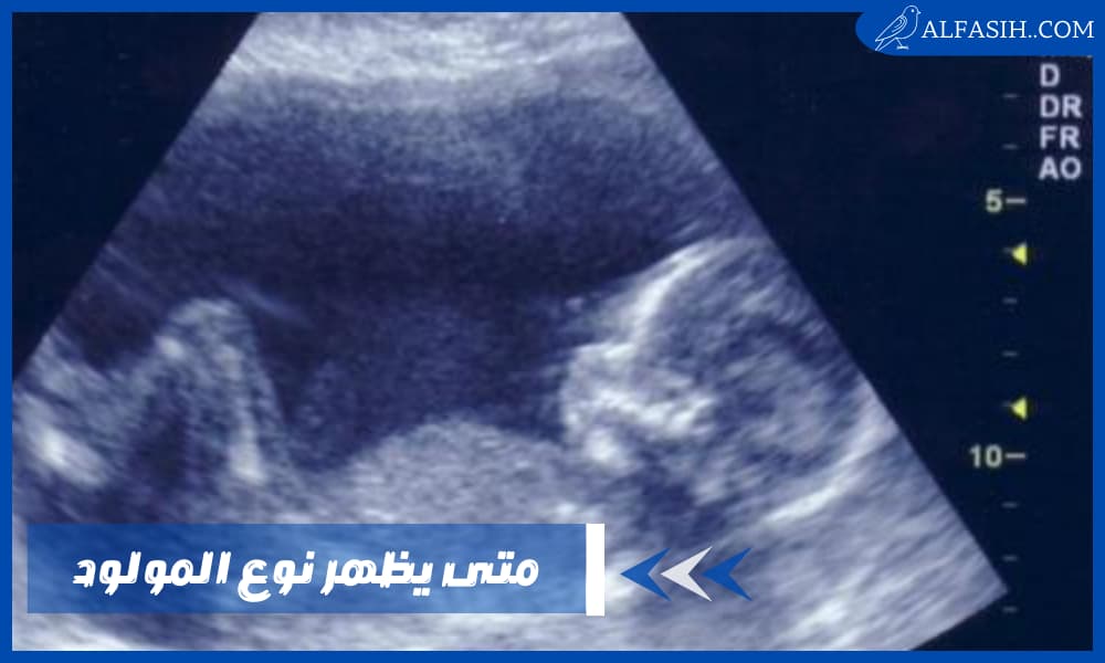 متى يظهر نوع المولود