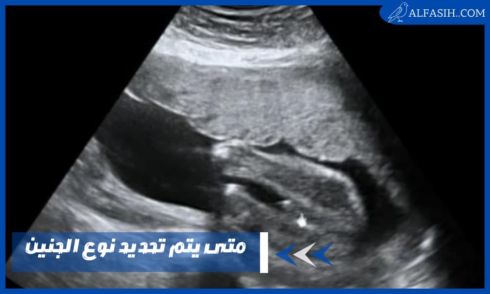 متى يتم تحديد نوع الجنين